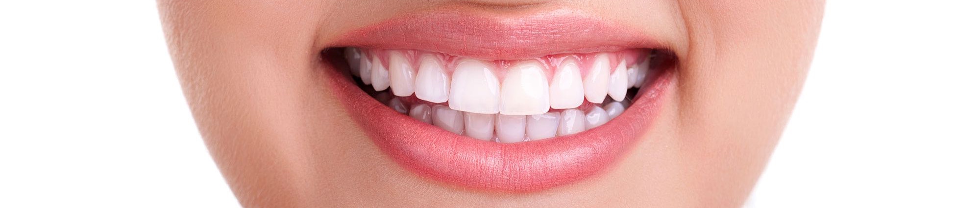 Brighten Up-Your-Smile-With-Shining-White-Teeth%20copy%202